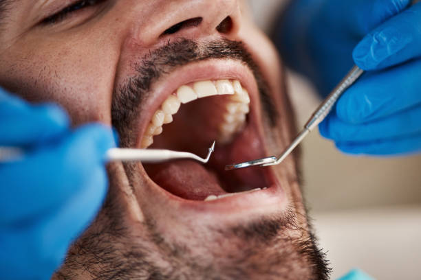 Best Weekend Emergency Dentist in Olympia Heights, FL